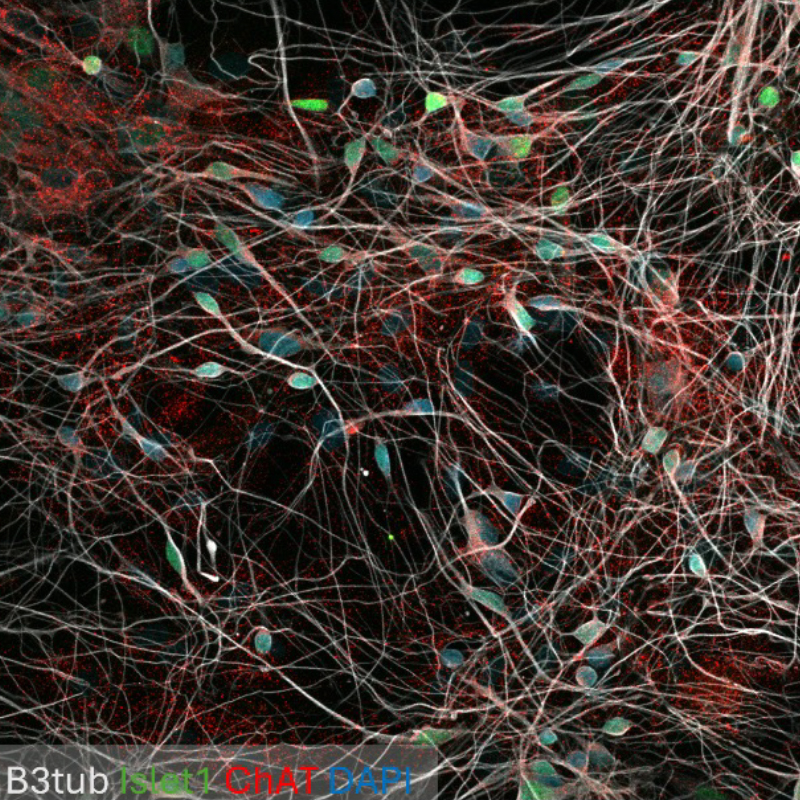 Human-motor-neurons Human motor neurons