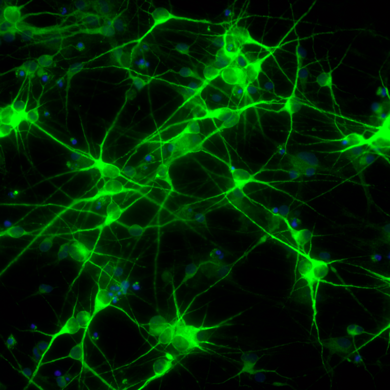 NCYTE Cell 2 Motorneurons DAPI PAX7 MAP2 Nestin.tif RGB green