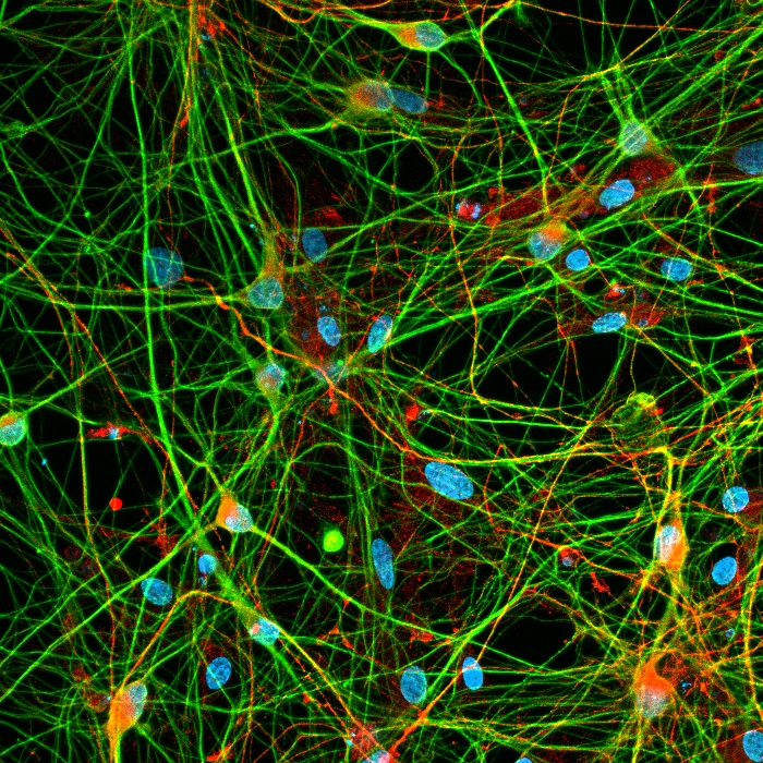 NCYTE Cell 3 Dopaminergic neurons