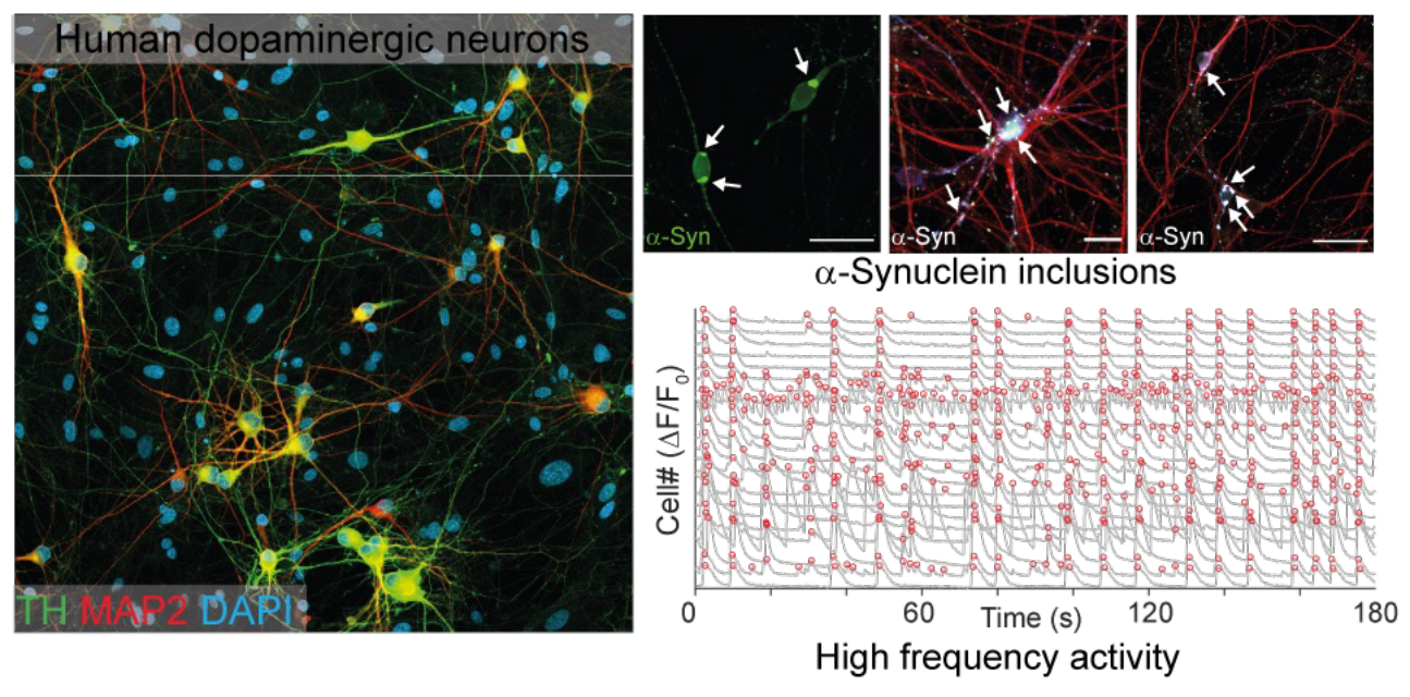 Neurodegenerative diseases cell