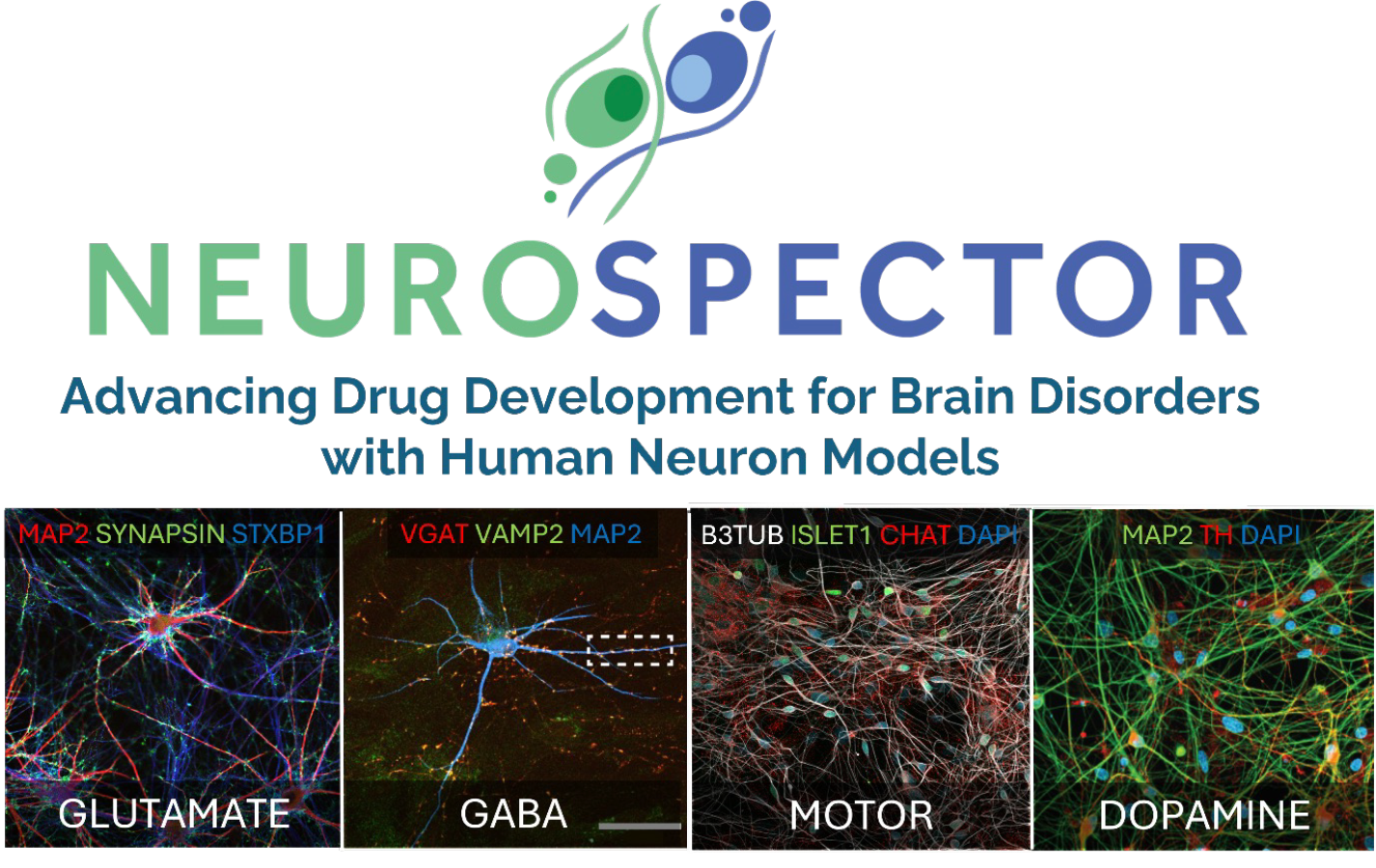 Neurological disorders Neurospector