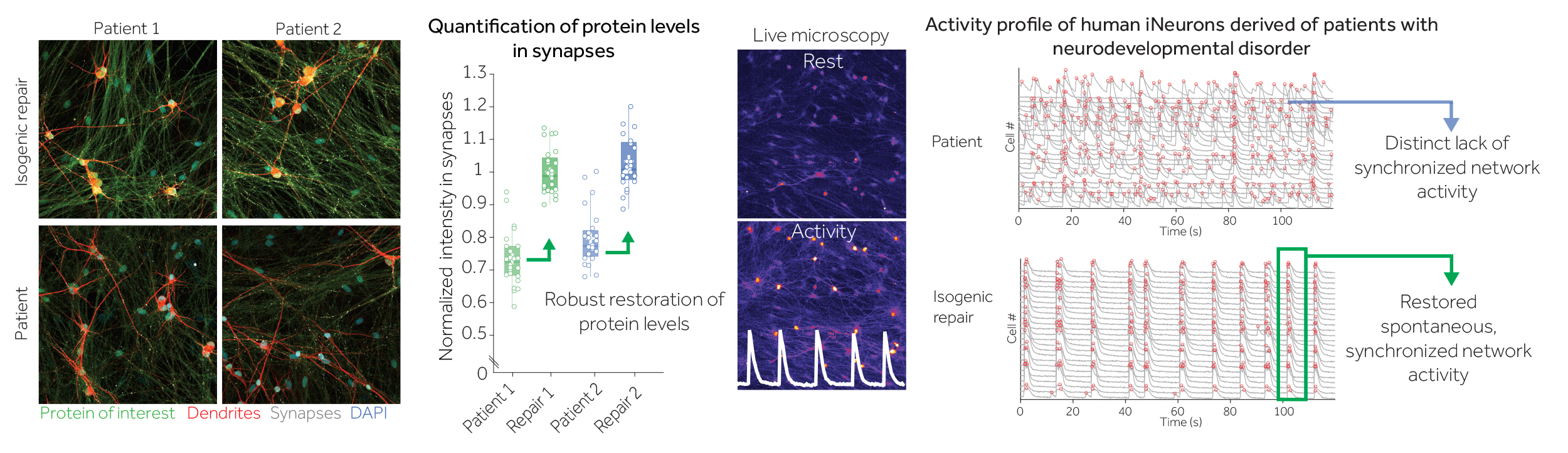 Schema neurodevelopmental disorders